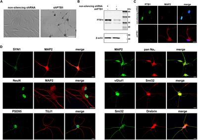 Frontiers | Neurons Induced From Fibroblasts Of C9ALS/FTD Patients ...